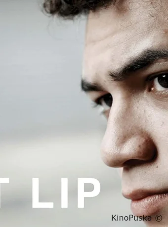 Заячья губа