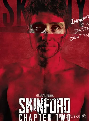 Скинфорд: глава вторая