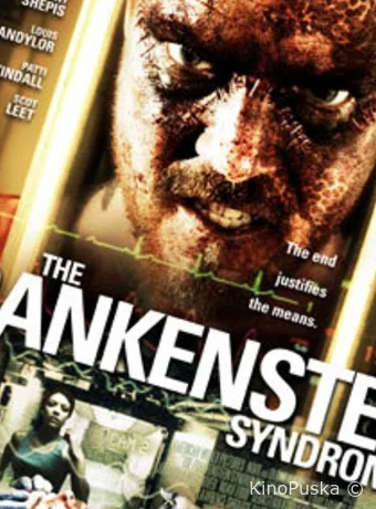 Синдром Франкенштейна